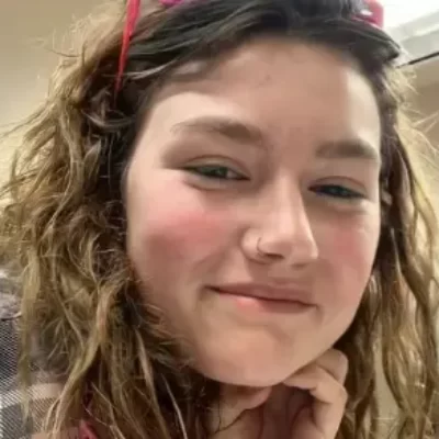 Snowbird Brown Teeth, Makeover, Bio, Age, Net Worth, Husband, Family, Surgery, House and Health